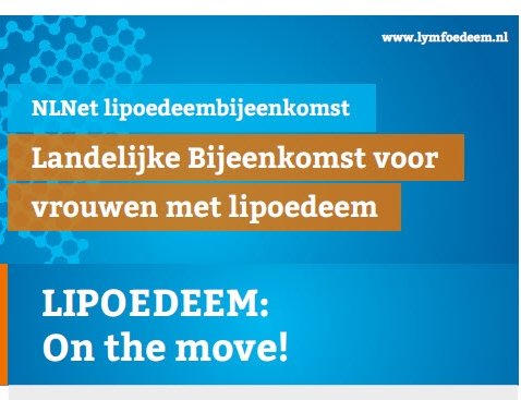 Landelijke bijeenkomst voor vrouwen met lipoedeem