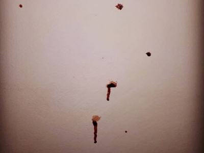 Bloedspetters op de muur na mishandeling